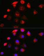 SHC Antibody in Immunocytochemistry (ICC/IF)