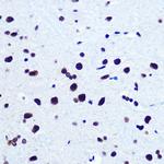 SRF Antibody in Immunohistochemistry (Paraffin) (IHC (P))