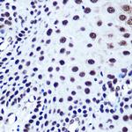 SRF Antibody in Immunohistochemistry (Paraffin) (IHC (P))