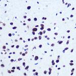 SRF Antibody in Immunohistochemistry (Paraffin) (IHC (P))