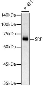 SRF Antibody in Western Blot (WB)