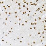 FAF1 Antibody in Immunohistochemistry (Paraffin) (IHC (P))