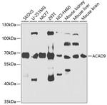 ACAD9 Antibody in Western Blot (WB)