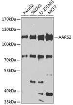 AARS2 Antibody in Western Blot (WB)