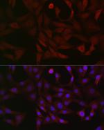 PFKP Antibody in Immunocytochemistry (ICC/IF)