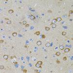 PFKP Antibody in Immunohistochemistry (Paraffin) (IHC (P))