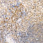 STX7 Antibody in Immunohistochemistry (Paraffin) (IHC (P))