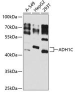 Alcohol Dehydrogenase 1C Antibody in Western Blot (WB)