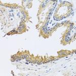 ARL6 Antibody in Immunohistochemistry (Paraffin) (IHC (P))