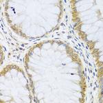 ARL6 Antibody in Immunohistochemistry (Paraffin) (IHC (P))