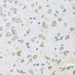 ARL6 Antibody in Immunohistochemistry (Paraffin) (IHC (P))