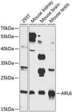 ARL6 Antibody in Western Blot (WB)