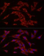 cGAS Antibody in Immunocytochemistry (ICC/IF)