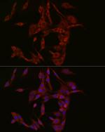 cGAS Antibody in Immunocytochemistry (ICC/IF)