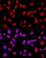 METTL3 Antibody in Immunocytochemistry (ICC/IF)