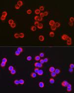 CFTR Antibody in Immunocytochemistry (ICC/IF)