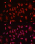 HK3 Antibody in Immunocytochemistry (ICC/IF)