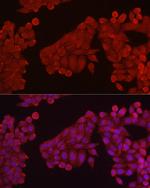 HK3 Antibody in Immunocytochemistry (ICC/IF)