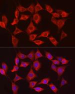 HK3 Antibody in Immunocytochemistry (ICC/IF)