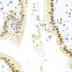 ZBTB17 Antibody in Immunohistochemistry (Paraffin) (IHC (P))