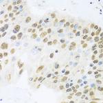 ZBTB17 Antibody in Immunohistochemistry (Paraffin) (IHC (P))