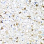 ZBTB17 Antibody in Immunohistochemistry (Paraffin) (IHC (P))