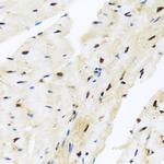 ZBTB17 Antibody in Immunohistochemistry (Paraffin) (IHC (P))