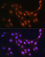 GMFB Antibody in Immunocytochemistry (ICC/IF)