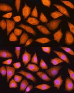 GMFB Antibody in Immunocytochemistry (ICC/IF)