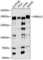 EPB41L2 Antibody in Western Blot (WB)