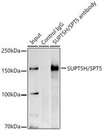 SPT5 Antibody in Immunoprecipitation (IP)