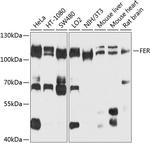 FER Antibody in Western Blot (WB)