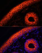 Desmoglein 1 Antibody in Immunohistochemistry (Paraffin) (IHC (P))