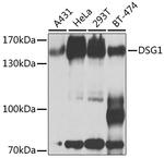 Desmoglein 1 Antibody in Western Blot (WB)