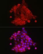 S100A9 Antibody in Immunocytochemistry (ICC/IF)