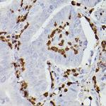 S100A9 Antibody in Immunohistochemistry (Paraffin) (IHC (P))