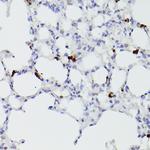 S100A9 Antibody in Immunohistochemistry (Paraffin) (IHC (P))