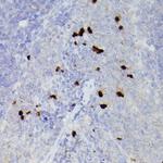 S100A9 Antibody in Immunohistochemistry (Paraffin) (IHC (P))