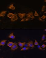 ATP1B2 Antibody in Immunocytochemistry (ICC/IF)