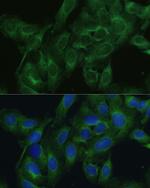 FRMD6 Antibody in Immunocytochemistry (ICC/IF)