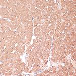 FRMD6 Antibody in Immunohistochemistry (Paraffin) (IHC (P))