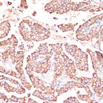 FRMD6 Antibody in Immunohistochemistry (Paraffin) (IHC (P))