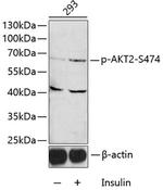 Phospho-AKT2 (Ser474) Antibody in Western Blot (WB)