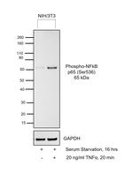 Phospho-NFkB p65 (Ser536) Antibody