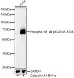 Phospho-NFkB p65 (Ser536) Antibody in Western Blot (WB)