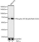 Phospho-NFkB p65 (Ser536) Antibody in Western Blot (WB)