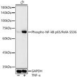 Phospho-NFkB p65 (Ser536) Antibody in Western Blot (WB)