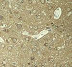 Phospho-Tau (Ser404) Antibody in Immunohistochemistry (Paraffin) (IHC (P))