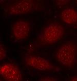 Phospho-PKC alpha/beta-2 (Thr638, Thr641) Antibody in Immunocytochemistry (ICC/IF)