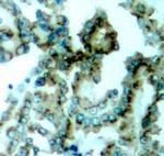 Phospho-PKC alpha/beta-2 (Thr638, Thr641) Antibody in Immunohistochemistry (Paraffin) (IHC (P))